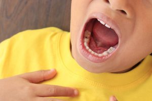 Problemas que pueden tener los niños en los dientes